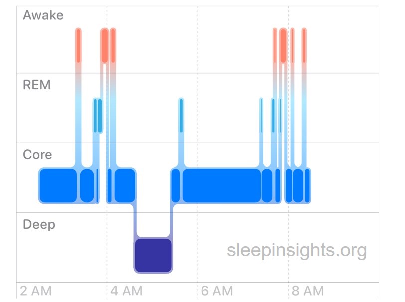 Nyquil sleep graph